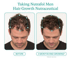 Nutrafol Men Hair Growth Supplement – 120 Capsules for Thicker, Stronger Hair AJ PRIME