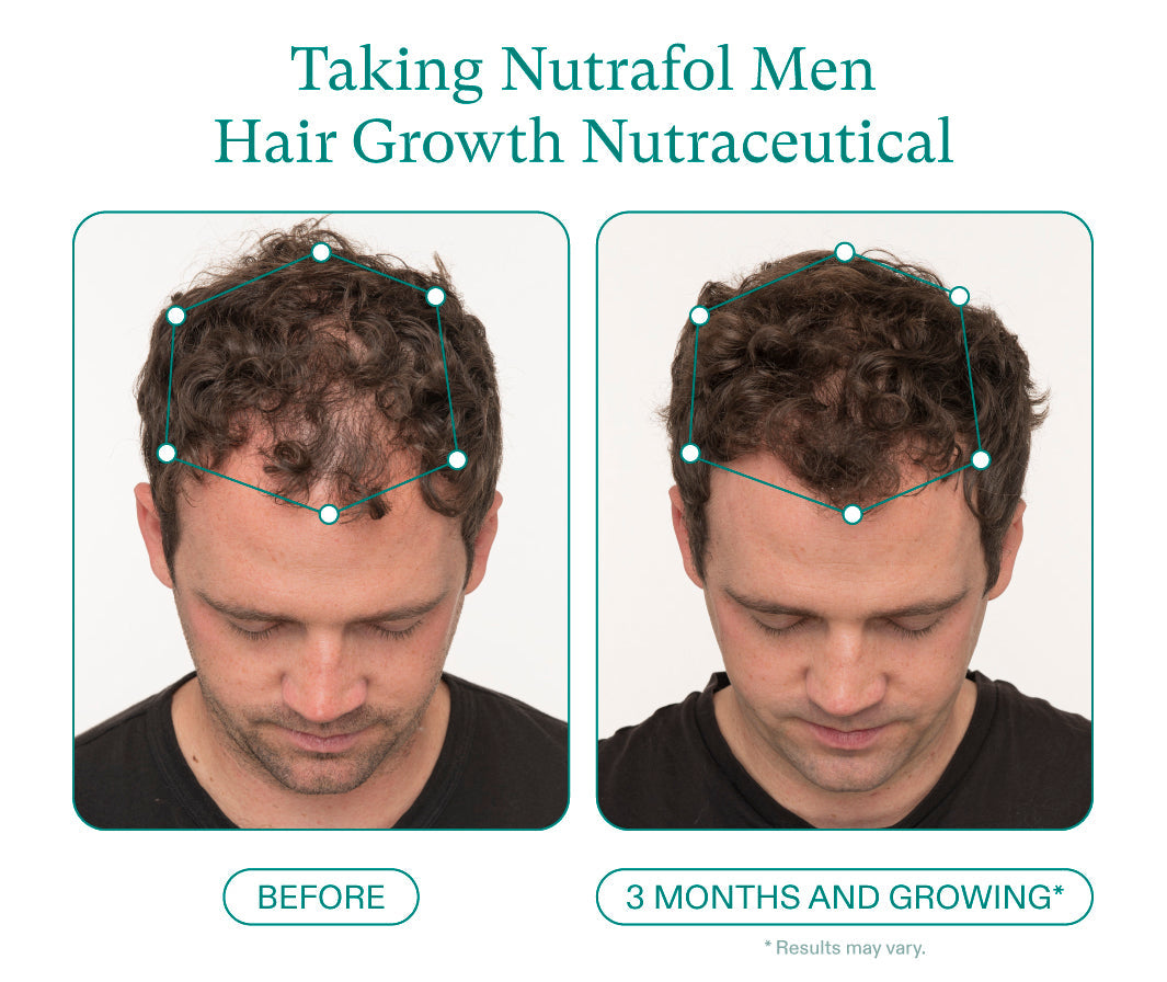 Nutrafol Men Hair Growth Supplement – 120 Capsules for Thicker, Stronger Hair AJ PRIME