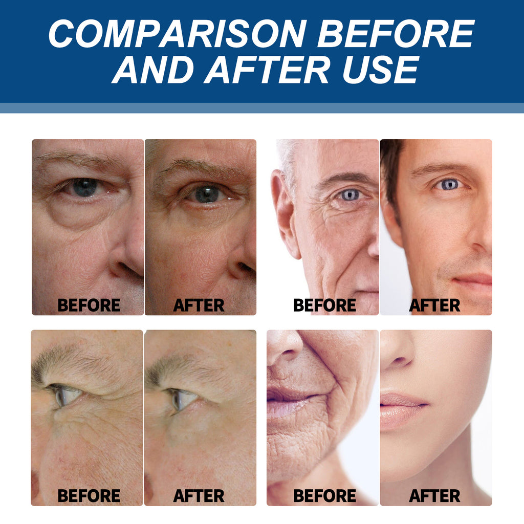 East Moon Moisturizing Lotion For Men Firming And Moisturizing Deep Hydrating Facial Skin Anti-Aging Lotion